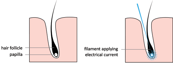 How Electrolysis Works
